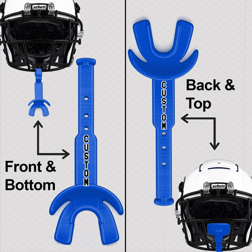 Custom Mouthguard
